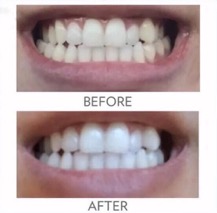 ap_24_whitening_toothpaste_