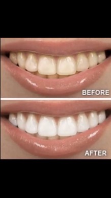 whitening_toothpaste_2